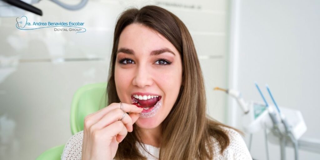 Tipos de Retenedores: Tecnología y Comodidad en 2026