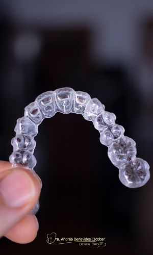 Ortodoncia invisible Armenia