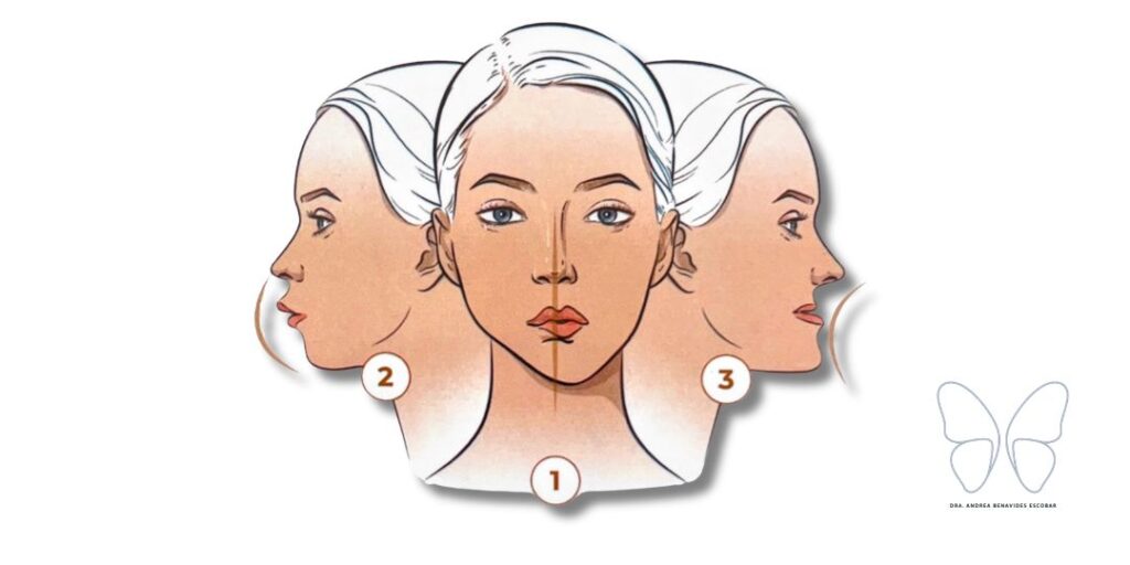 Ortodoncia Invisible para Adultos: Tipos de maloclusiones para Avance Mandibular y Corrección de Sonrisas sin Cirugía.