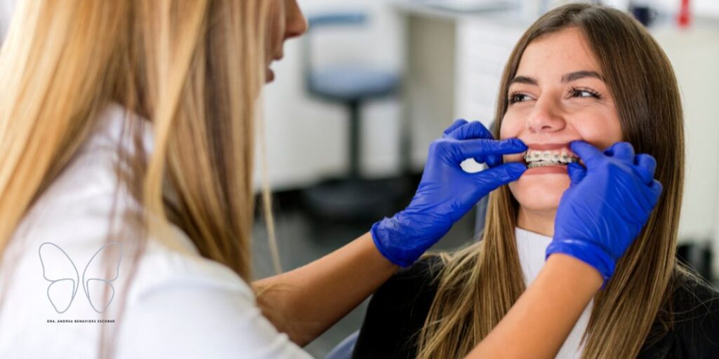 ¿Limarse los dientes (Stripping) es malo? La verdad sobre el desgaste dental en ortodoncia