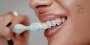 ¿Cómo lavarse los dientes con brackets paso a paso? La guía definitiva