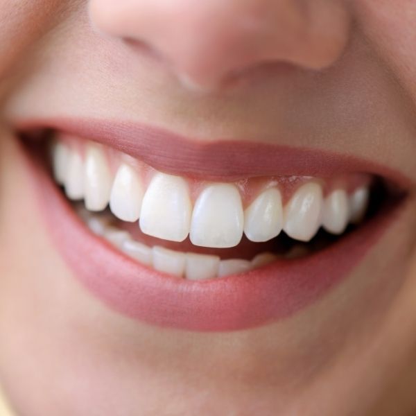 renace smile spa dental en el eje cafetero