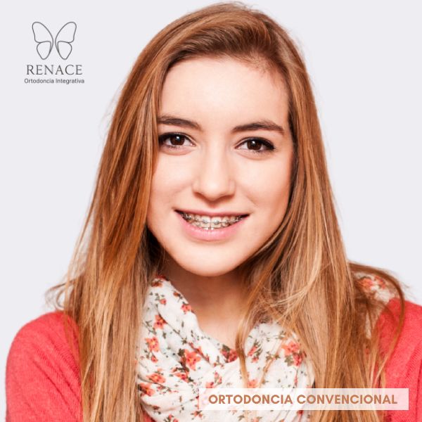 Ortodoncia con Brackets convencionales en Armenia y eje cafetero