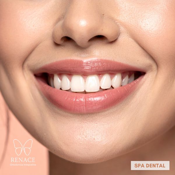 renace smile spa, el primer spa dental en el eje cafetero